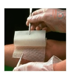 Bactrigras Chlorhexidine Gauze