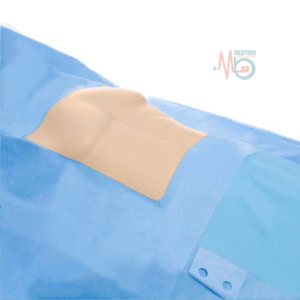 Sterile Disposable Abdominal Drape – 150 x 220 cm with 8 x 10 Inch Incision Opening