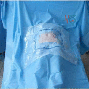 Sterile Disposable Cesarean Drape with EO Indicator