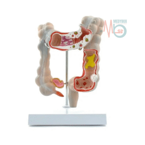 Colon Pathalogical Model