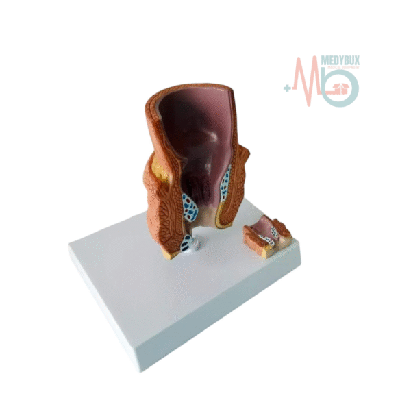 Human Pathological Diseased Rectum Model - Image 3