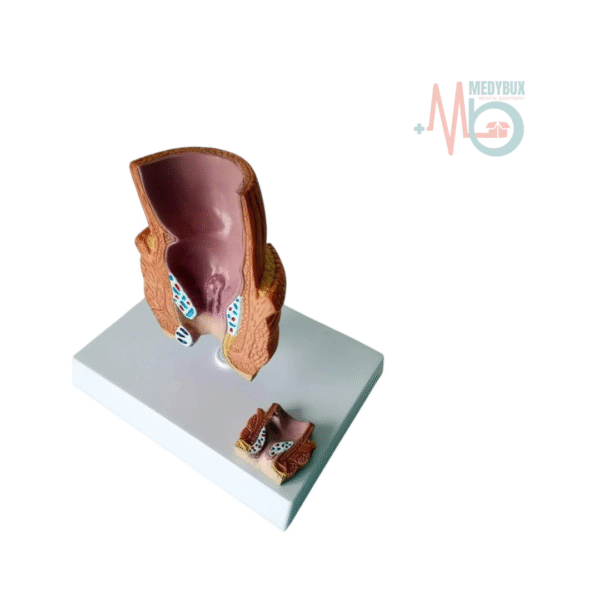Human Pathological Diseased Rectum Model - Image 4