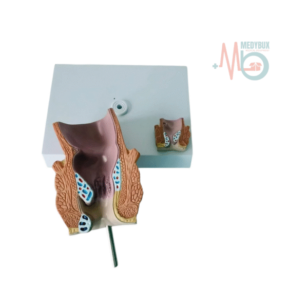 Product Description: The Diseased Rectum Model is an anatomically accurate representation designed to help students and medical professionals explore rectal diseases. It highlights the differences between a normal rectum and one affected by hemorrhoids. Made from high-quality materials, this model serves as an essential educational tool for demonstrating the pathology of rectal conditions. Key Features: Realistic Design: Shows detailed rectal structures and the comparison of hemorrhoids with a normal rectum. Size: Measures 12 x 12 x 16 cm for a life-like examination experience. Durable Construction: Made from high-quality, medical-grade materials for long-lasting use. Educational Tool: Ideal for medical training and patient education. Compact & Lightweight: Weighs only 0.2 kg, easy to handle for demonstrations and practice.