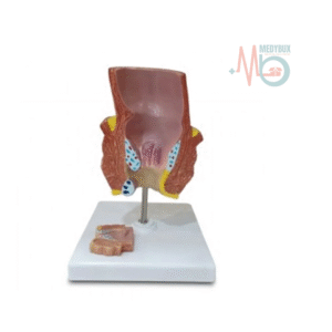 Product Description: The Diseased Rectum Model is an anatomically accurate representation designed to help students and medical professionals explore rectal diseases. It highlights the differences between a normal rectum and one affected by hemorrhoids. Made from high-quality materials, this model serves as an essential educational tool for demonstrating the pathology of rectal conditions. Key Features: Realistic Design: Shows detailed rectal structures and the comparison of hemorrhoids with a normal rectum. Size: Measures 12 x 12 x 16 cm for a life-like examination experience. Durable Construction: Made from high-quality, medical-grade materials for long-lasting use. Educational Tool: Ideal for medical training and patient education. Compact & Lightweight: Weighs only 0.2 kg, easy to handle for demonstrations and practice.
